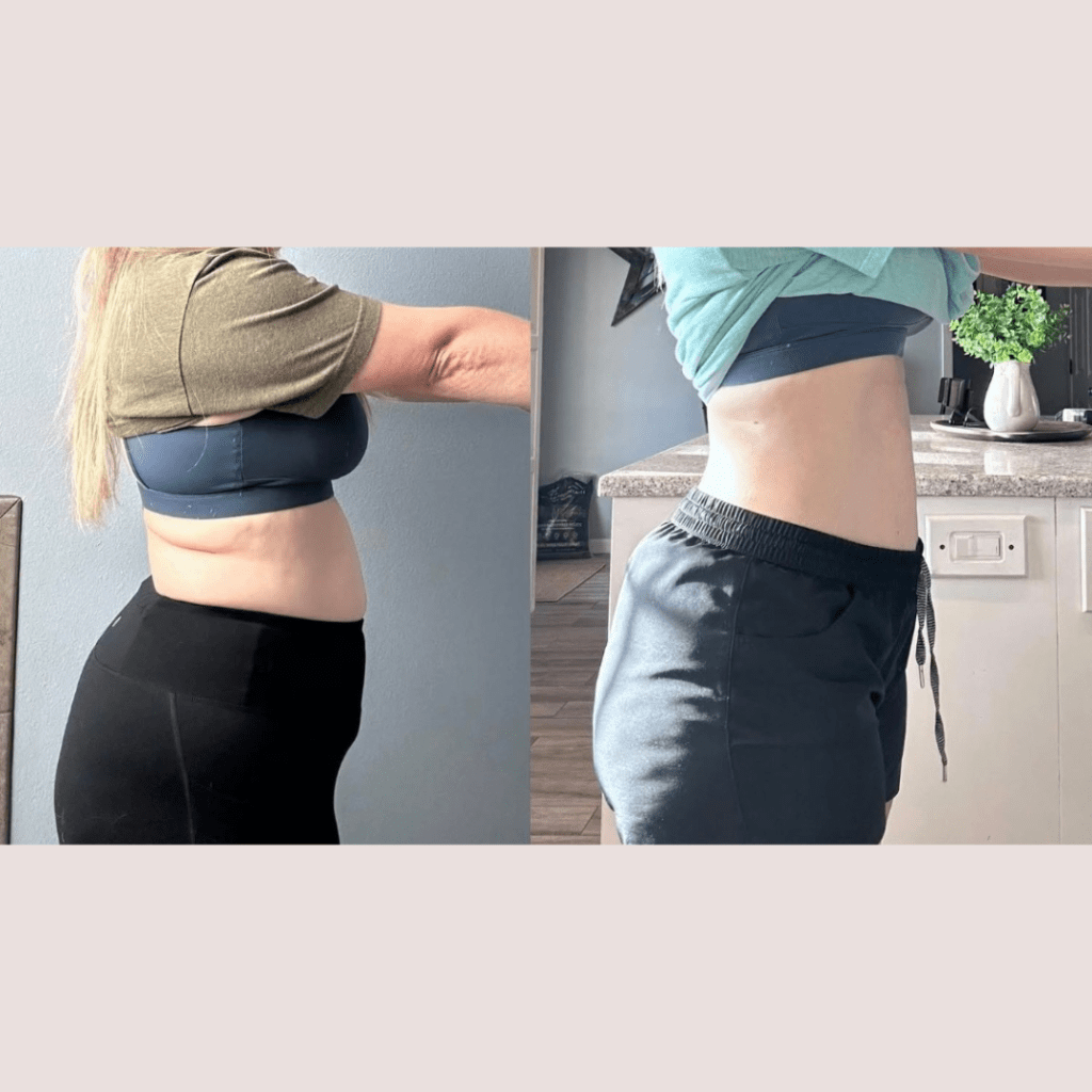 Comparison of two side-profile images of a woman showing a before and after transformation in body shape.